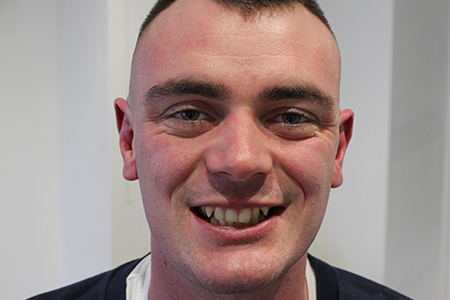 Before and After Invisalign Treatment Milton Keynes