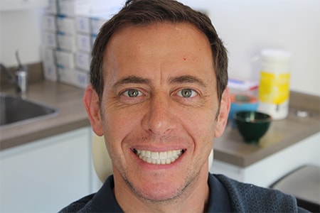 Before and After Invisalign Treatment Milton Keynes