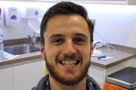Before and After Invisalign Treatment Milton Keynes