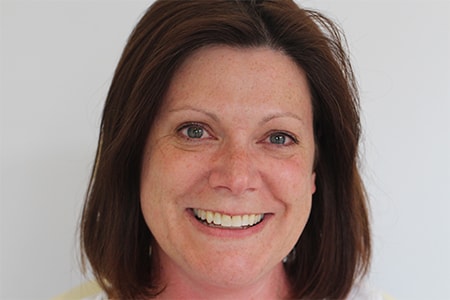 Before and After Invisalign Treatment Milton Keynes